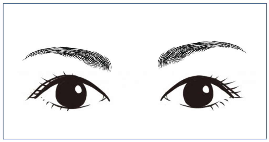 眉頭　下がってくる